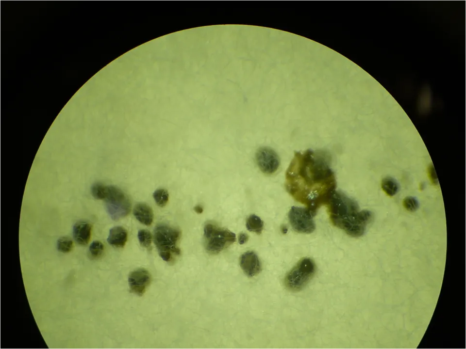 Diplodia hederae pycnidia growing on a potato dextrose agar plate, magnified 4.5X. Identified using Barnett, H. L. & Hunter, B. B. (1998) Illustra