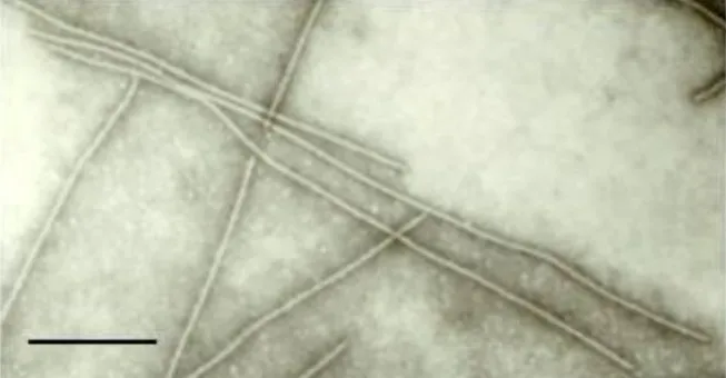 Transmission electron micrograph showing Cowpea mild mottle virus particles in sap of symptomatic V. unguiculata subsp. sesquipedalis leaf. Bar = 100