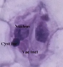 Tobacco ringspot virus-Azure A